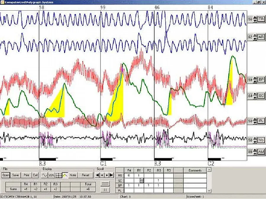 Искат детектор на лъжата за кандидат-кметовете