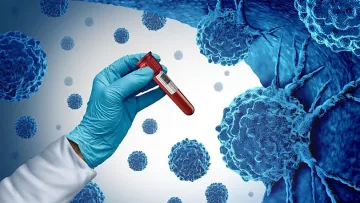 Революция! Кръвен тест открива 50 вида рак