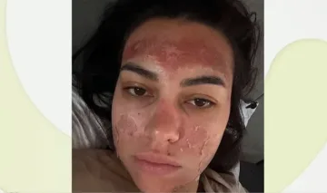 Десетки жени са пострадали от "разкрасяването"