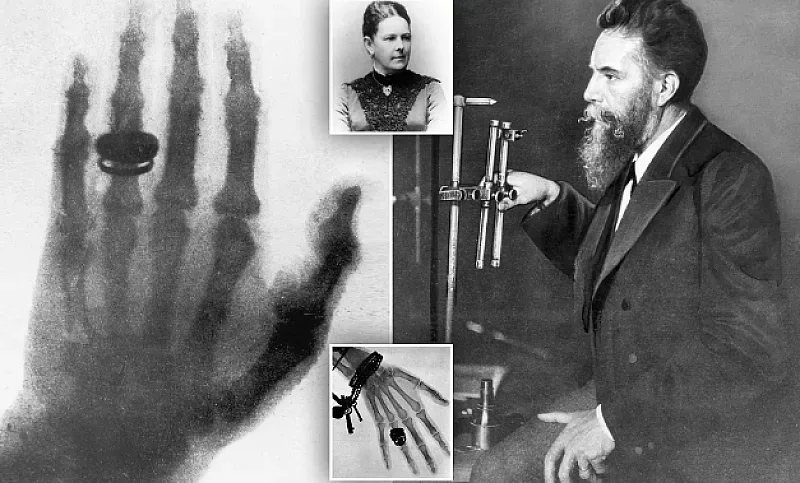 Ръката, която промени медицината