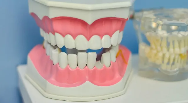 Сънувате, че ви падат зъби? Ето какво означава това