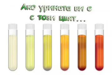Как урината прави диагностиката на здравето ви