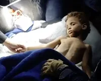 Чудо във Венецуела с 3-годишно момче