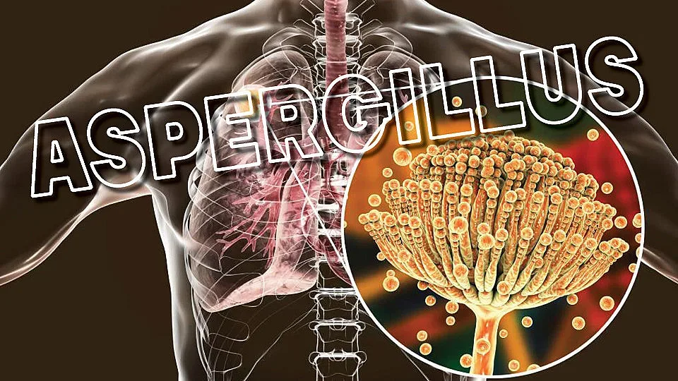 Плесента разболява белите дробове