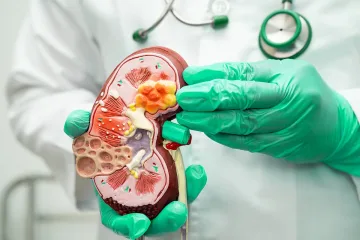 През май уролозите от „Пълмед“ с безплатни прегледи за бъбречно-каменна болест и увеличена простата