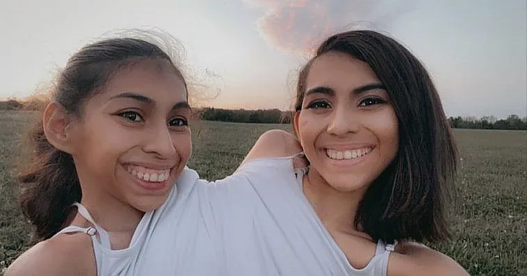 Какво е да си сиамски близнак - разказ от първо лице