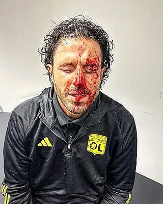 Отложиха голямо дерби във Франция