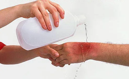 Нова традегия! Две деца с изгаряния край Кърджали