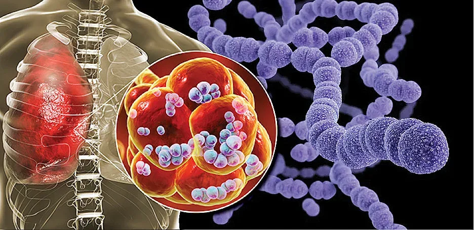 Бактериална инфекция отключва хипогликемия