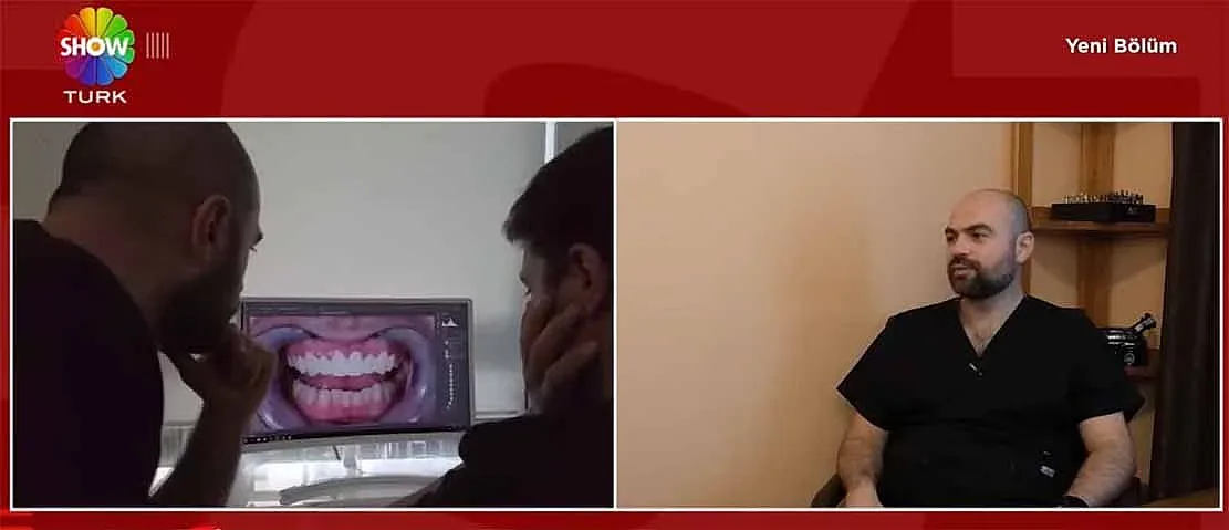 Стоматологът, лекувал зъб на Силвестър Сталоун, стана звезда в Турция