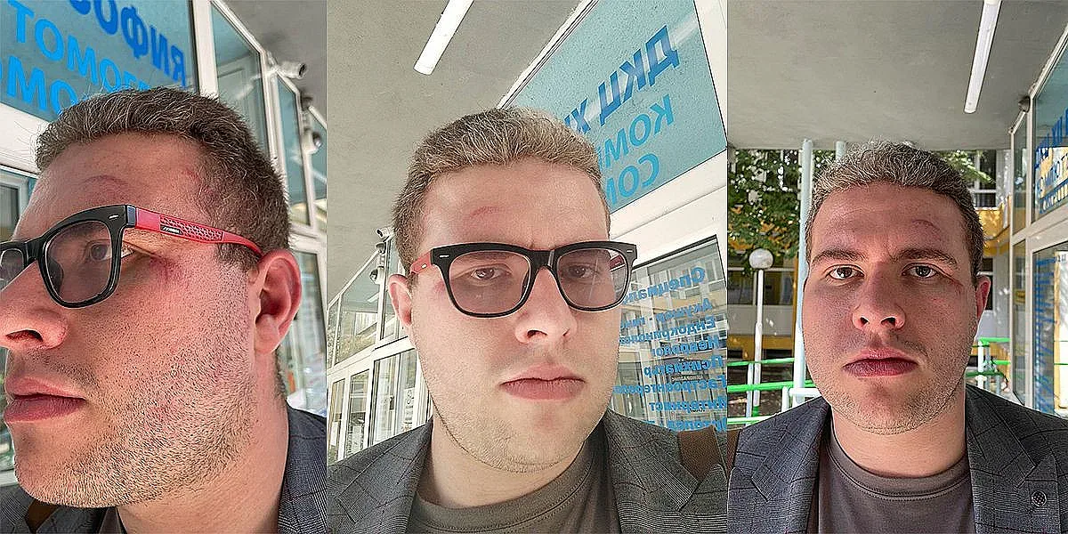 Пребиха кандидат за депутат от БСП в София! На 9 септември