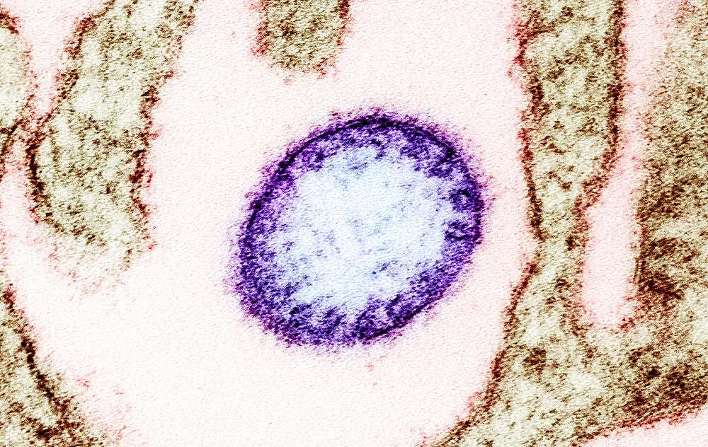 Нов опасен вирус тръгва от Китай, кога да го очакваме