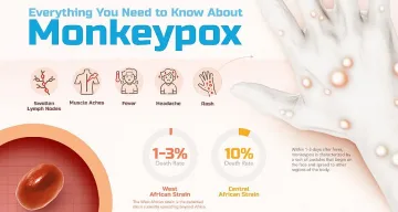 Смразяващи новини от СЗО. Какво се случва с маймунската шарка